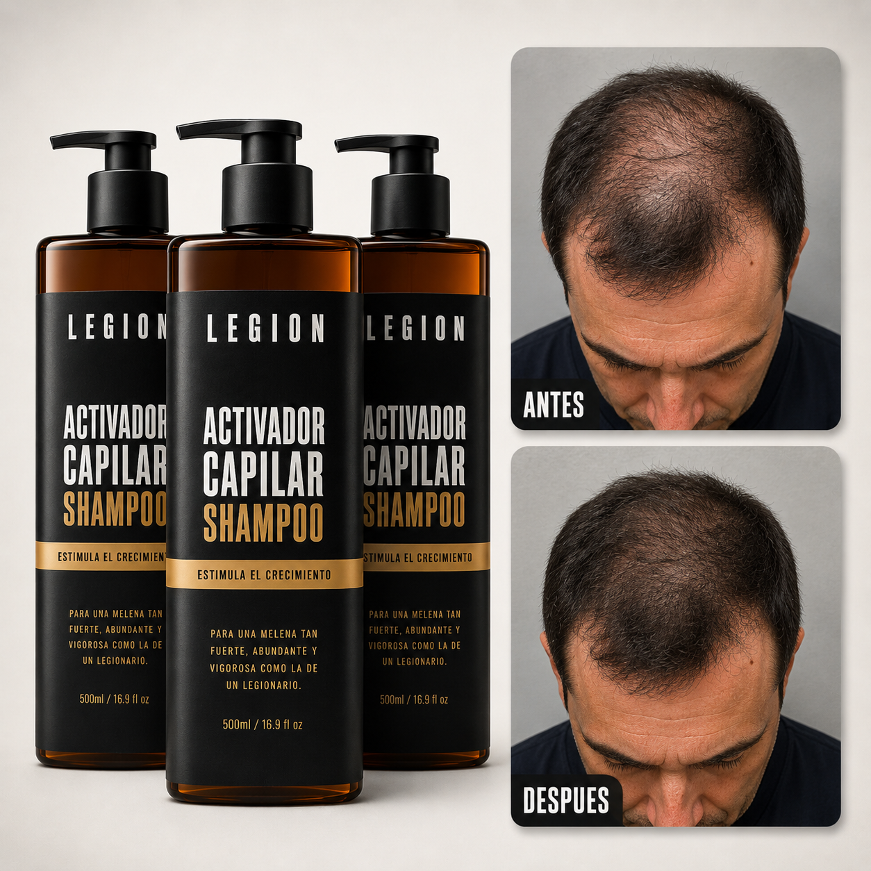 LEGION® – Shampoo Activador Capilar